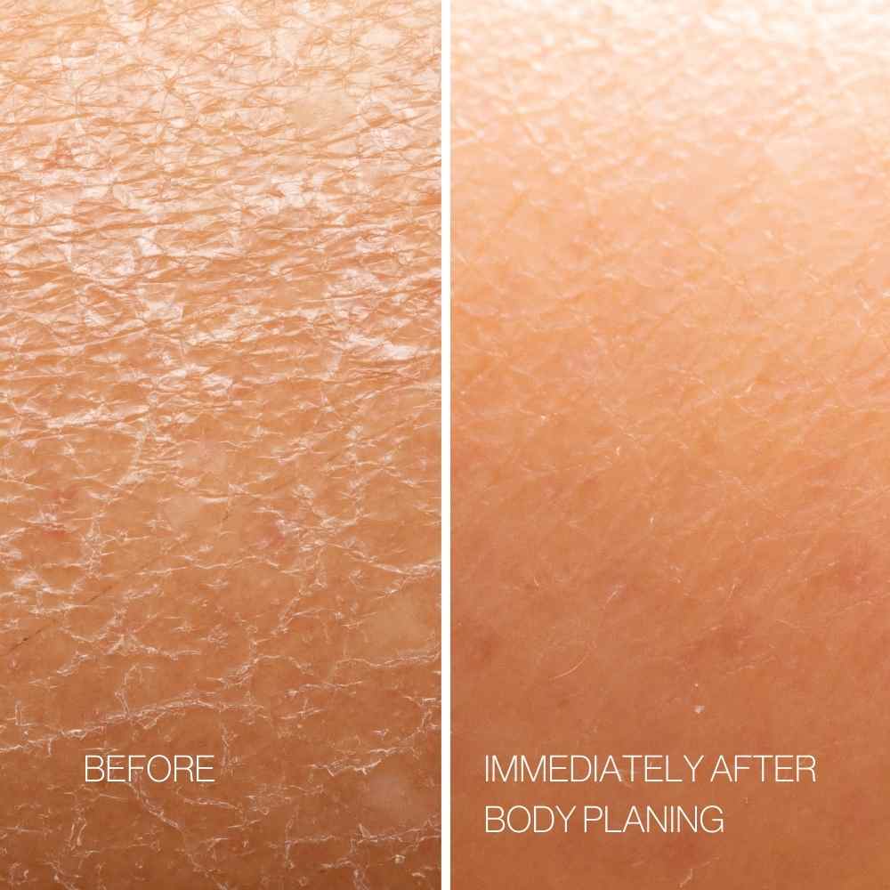 Body Plane Set - Image 3